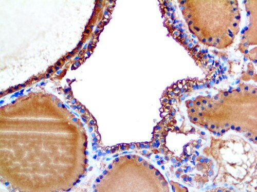 IHC of Thyroglobulin on an FFPE Thyroid Tissue